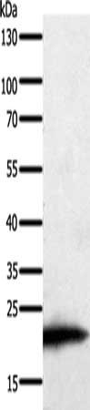 Gel: 8+10%SDS-PAGE, Lysate: 60 ug, Lane: HT29 cells, Primary antibody: CSB-PA261296(PARK7 Antibody) at dilution 1/200, Secondary antibody: Goat anti rabbit IgG at 1/8000 dilution, Exposure time: 2 minutes