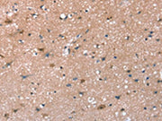 The image on the left is immunohistochemistry of paraffin-embedded Human brain tissue using CSB-PA261683(SYNPO Antibody) at dilution 1/30, on the right is treated with synthetic peptide. (Original magnification: ×200)
