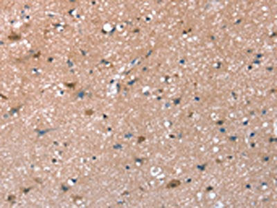 The image on the left is immunohistochemistry of paraffin-embedded Human brain tissue using CSB-PA261683(SYNPO Antibody) at dilution 1/30, on the right is treated with synthetic peptide. (Original magnification: ×200)