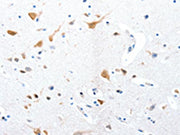 The image on the left is immunohistochemistry of paraffin-embedded Human brain tissue using CSB-PA262009(RBFOX3 Antibody) at dilution 1/25, on the right is treated with synthetic peptide. (Original magnification: ×200)