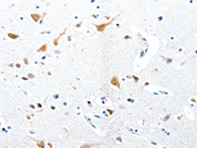 The image on the left is immunohistochemistry of paraffin-embedded Human brain tissue using CSB-PA262009(RBFOX3 Antibody) at dilution 1/25, on the right is treated with synthetic peptide. (Original magnification: ×200)