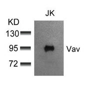 Western blot analysis of extracts from JK cells using Vav(Ab-174) Antibody.