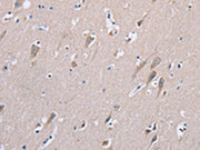 The image on the left is immunohistochemistry of paraffin-embedded Human brain tissue using CSB-PA262218(STMN1 Antibody) at dilution 1/20, on the right is treated with synthetic peptide. (Original magnification: ×200)