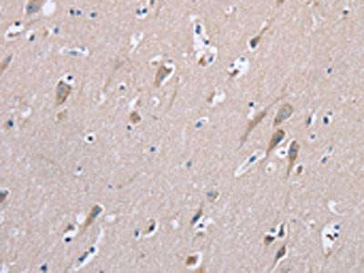 The image on the left is immunohistochemistry of paraffin-embedded Human brain tissue using CSB-PA262218(STMN1 Antibody) at dilution 1/20, on the right is treated with synthetic peptide. (Original magnification: ×200)