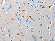 The image on the left is immunohistochemistry of paraffin-embedded Human brain tissue using CSB-PA262646(NRG3 Antibody) at dilution 1/40, on the right is treated with synthetic peptide. (Original magnification: ×200)
