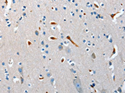The image on the left is immunohistochemistry of paraffin-embedded Human brain tissue using CSB-PA262646(NRG3 Antibody) at dilution 1/40, on the right is treated with synthetic peptide. (Original magnification: ×200)