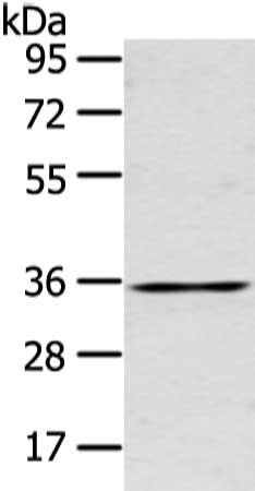 Gel: 10%SDS-PAGE, Lysate: 40 ug, Lane: Human placenta tissue, Primary antibody: CSB-PA263776(GJB5 Antibody) at dilution 1/400 dilution, Secondary antibody: Goat anti rabbit IgG at 1/8000 dilution, Exposure time: 15 seconds