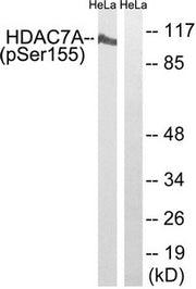 Western blot analysis of extracts from HeLa cells using HDAC7A (Phospho-Ser155) Antibody.The lane on the right is treated with the antigen-specific peptide.
