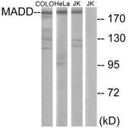Western blot analysis of extracts from COLO cells, HeLa cells and Jurkat cells, using MADD antibody.