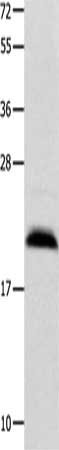 Gel: 12%SDS-PAGE, Lysate: 40 ug, Lane: Mouse brain tissue, Primary antibody: CSB-PA265135(FGF12 Antibody) at dilution 1/450, Secondary antibody: Goat anti rabbit IgG at 1/8000 dilution, Exposure time: 50 seconds