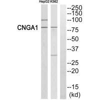 Western blot analysis of extracts from HepG2 cells and K562 cells, using CNGA1 antibody.
