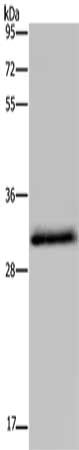 Gel: 10%SDS-PAGE, Lysate: 40 ug, Lane: Mouse liver tissue, Primary antibody: CSB-PA265458(HSD17B6 Antibody) at dilution 1/300, Secondary antibody: Goat anti rabbit IgG at 1/8000 dilution, Exposure time: 20 seconds