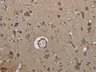 The image on the left is immunohistochemistry of paraffin-embedded Human brain tissue using CSB-PA265569(MARK4 Antibody) at dilution 1/40, on the right is treated with synthetic peptide. (Original magnification: ×200)