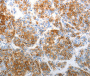 Immunohistochemical analysis of paraffin-embedded Human tonsil cancer tissue using at dilution 1/40.