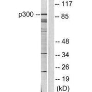 Western blot analysis of extracts from COLO205 cells, using P300/CBP antibody.