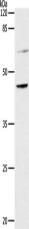 Gel: 10%SDS-PAGE, Lysate: 40 ug, Lane: 293T cells, Primary antibody: CSB-PA265889(CCR7 Antibody) at dilution 1/350, Secondary antibody: Goat anti rabbit IgG at 1/8000 dilution, Exposure time: 1.5 minutes