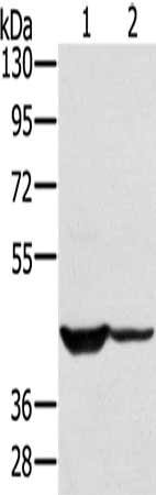 Gel: 8%SDS-PAGE, Lysate: 40 ug, Lane 1-2: 231 cells, hela cells, Primary antibody: CSB-PA266157(SOX2 Antibody) at dilution 1/300, Secondary antibody: Goat anti rabbit IgG at 1/8000 dilution, Exposure time: 20 seconds