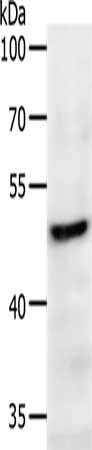 Gel: 10%SDS-PAGE, Lysate: 50 ug, Lane: Mouse heart tissue, Primary antibody: CSB-PA266329(PDK2 Antibody) at dilution 1/200, Secondary antibody: Goat anti rabbit IgG at 1/8000 dilution, Exposure time: 30 seconds