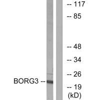 Western blot analysis of extracts from Jurkat cells, using BORG3 antibody.