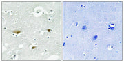 Immunohistochemical analysis of paraffin-embedded human brain tissue using STK39 (Phospho-Ser323) antibody (left)or the same antibody preincubated with blocking peptide (right).