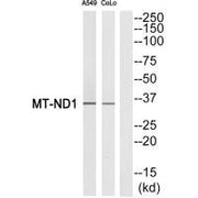 Western blot analysis of extracts from A549 cells and COLO cells, using MT-ND1 antibody.