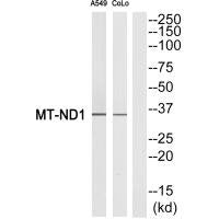 Western blot analysis of extracts from A549 cells and COLO cells, using MT-ND1 antibody.