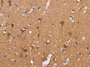 The image on the left is immunohistochemistry of paraffin-embedded Human brain tissue using CSB-PA267293(CASC3 Antibody) at dilution 1/20, on the right is treated with fusion protein. (Original magnification: ×200)