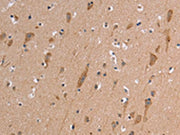 The image on the left is immunohistochemistry of paraffin-embedded Human brain tissue using CSB-PA267720(ETFB Antibody) at dilution 1/50, on the right is treated with synthetic peptide. (Original magnification: ×200)
