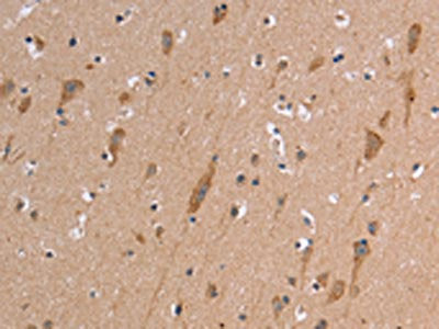The image on the left is immunohistochemistry of paraffin-embedded Human brain tissue using CSB-PA267720(ETFB Antibody) at dilution 1/50, on the right is treated with synthetic peptide. (Original magnification: ×200)