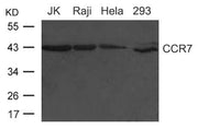 Western blot analysis of extract from HUVEC cells and Hematopoietic Stem Cells from Umbilical Cord Blood using CD34 Antibody