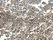 The image on the left is immunohistochemistry of paraffin-embedded Human tonsil tissue using CSB-PA269266(SERPINF1 Antibody) at dilution 1/15, on the right is treated with fusion protein. (Original magnification: ×200)