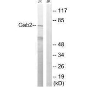 Western blot analysis of extracts from Jurkat cells, treated with TNF (2500U/ml, 30mins), using Gab2 (Ab-623) antibody.