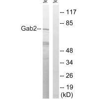 Western blot analysis of extracts from Jurkat cells, treated with TNF (2500U/ml, 30mins), using Gab2 (Ab-623) antibody.