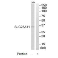 Western blot analysis of extracts from HeLa cells, using SLC25A11 antibody.