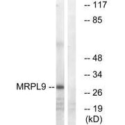 Western blot analysis of extracts from COLO cells, using MRPL9 antibody.