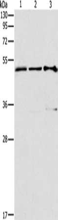 Gel: 10%SDS-PAGE, Lysate: 40 ug, Lane 1-3: Human fetal muscle tissue, huvec cells, hela cells, Primary antibody: CSB-PA270186(TFAP2C Antibody) at dilution 1/270, Secondary antibody: Goat anti rabbit IgG at 1/8000 dilution, Exposure time: 30 seconds