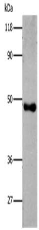 Gel: 8%SDS-PAGE, Lysate: 0.5 ug, Lane: Recombinant 6HIS Tagged protein , Primary antibody: CSB-PA270215(6His Antibody) at dilution 1/2000 (lane 1),1/5000 (lane 2),1/8000 (lane 3),1/10000 (lane 4), Secondary antibody: Goat anti rabbit IgG at 1/8000...