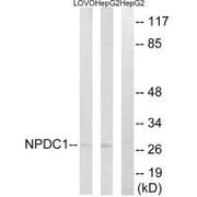 Western blot analysis of extracts from LOVO cells and HepG2 cells, using NPDC1 antibody.