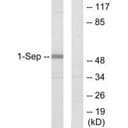 Western blot analysis of extracts from Jurkat cells, using SEPT1 antibody.