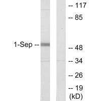 Western blot analysis of extracts from Jurkat cells, using SEPT1 antibody.