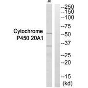 Western blot analysis of extracts from Jurkat cells, using Cytochrome P450 20A1 antibody.