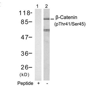 Western blot analysis of extracts from SW626 cells using b-Catenin(Phospho-Thr41/Ser45) Antibody(Lane 2) and the same antibody preincubated with blocking peptide(Lane1).
