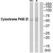 Western blot analysis of extracts from Jurkat/HeLa cells, using CYP21A2 antibody.