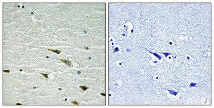Immunohistochemical analysis of paraffin-embedded human brain tissue using Trk A (Phospho-Tyr757) antibody (left)or the same antibody preincubated with blocking peptide (right).