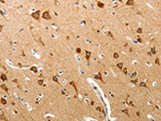 The image on the left is immunohistochemistry of paraffin-embedded Human brain tissue using CSB-PA271700(BIRC6 Antibody) at dilution 1/40, on the right is treated with synthetic peptide. (Original magnification: ×200)