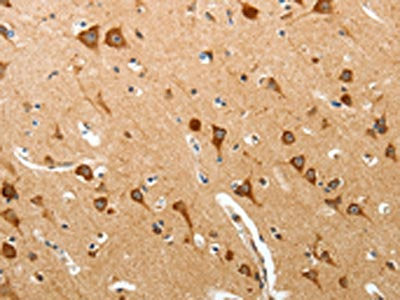 The image on the left is immunohistochemistry of paraffin-embedded Human brain tissue using CSB-PA271700(BIRC6 Antibody) at dilution 1/40, on the right is treated with synthetic peptide. (Original magnification: ×200)