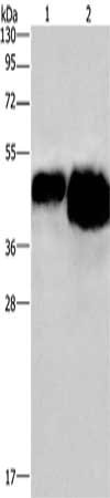 Gel: 10%SDS-PAGE, Lysate: 0.4 ug, 0.8 ug, Lane 1-2: 0.4 ug, 0.8 ug OVAL protein, Primary antibody: CSB-PA271972(OVAL Antibody) at dilution 1/500, Secondary antibody: Goat anti rabbit IgG at 1/8000 dilution, Exposure time: 3 seconds
