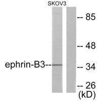 Western blot analysis of extracts from SKOV3 cells, using Ephrin-B3 antibody.