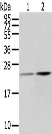 Gel: 12%SDS-PAGE,Lysate: 40 ug,Lane 1-2: Human fetal liver tissue, Human liver cancer tissue,Primary antibody: CSB-PA272372(RBP4 Antibody) at dilution 1/200 dilution,Secondary antibody: Goat anti rabbit IgG at 1/8000 dilution,Exposure time: 3 minutes