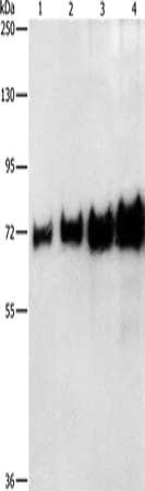 Gel: 8%SDS-PAGE, Lysate: 0.05-0.4 ug, Lane 1-4: 0.05 ug, 0.1 ug, 0.2 ug, 0.4 ug BSA, Primary antibody: CSB-PA272395(BSA Antibody) at dilution 1/1150, Secondary antibody: Goat anti rabbit IgG at 1/8000 dilution, Exposure time: 1 second